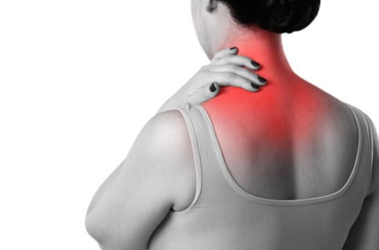 28 Effective ways to get the kinks out from neck pain ...