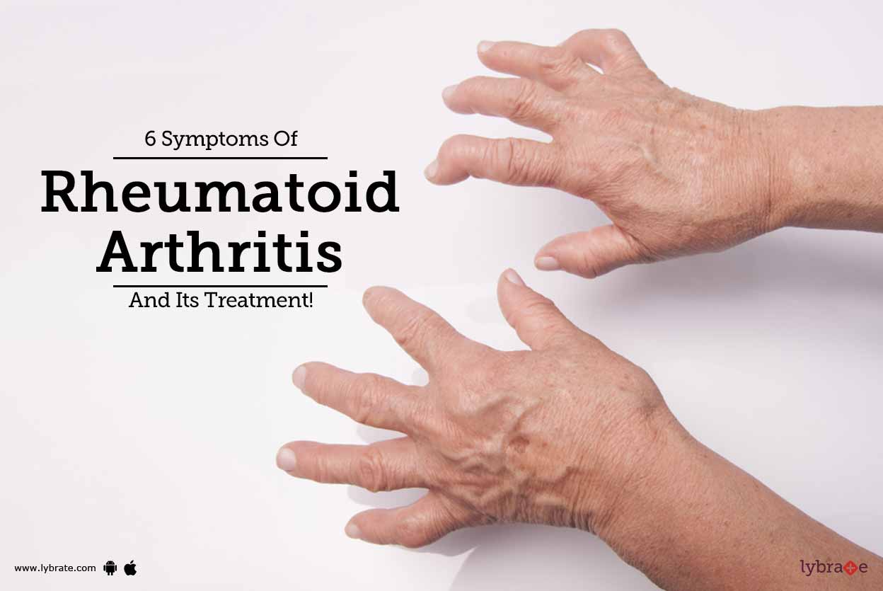 6 Symptoms Of Rheumatoid Arthritis And Its Treatment!