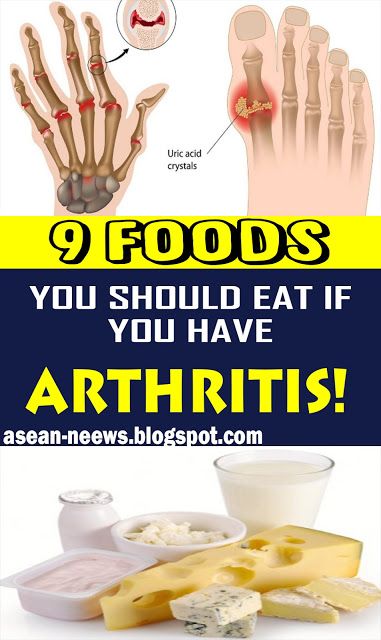 9 FOODS YOU SHOULD NEVER EAT IF YOU HAVE ARTHRITIS!