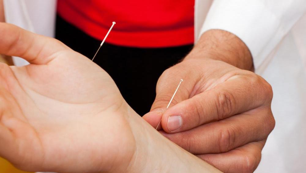 Acupuncture For Rheumatoid Arthritis In Hands ...