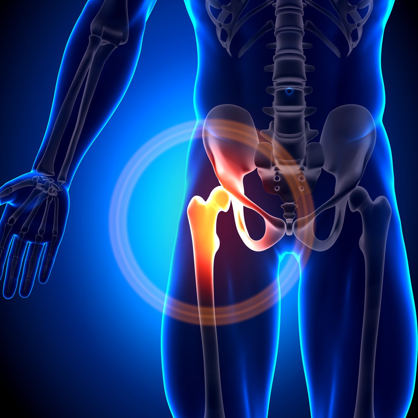 Arthritic hip or knee pain? Try Total Chiropractic for ...