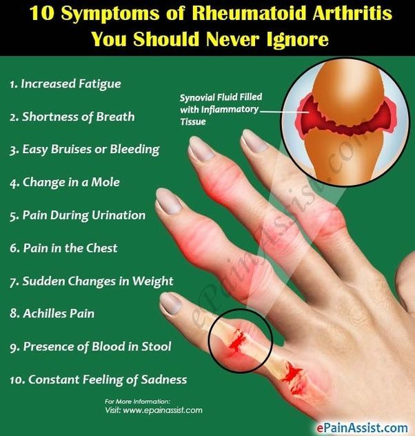bymydesigners: Arthritis Symptoms In Fingers And Hands