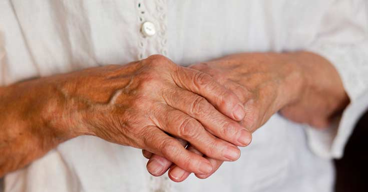 Common types of arthritis explained