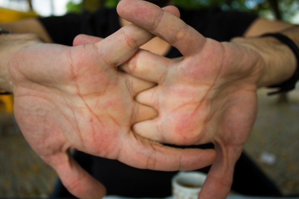 Does Cracking Your Knuckles Really Cause Arthritis?