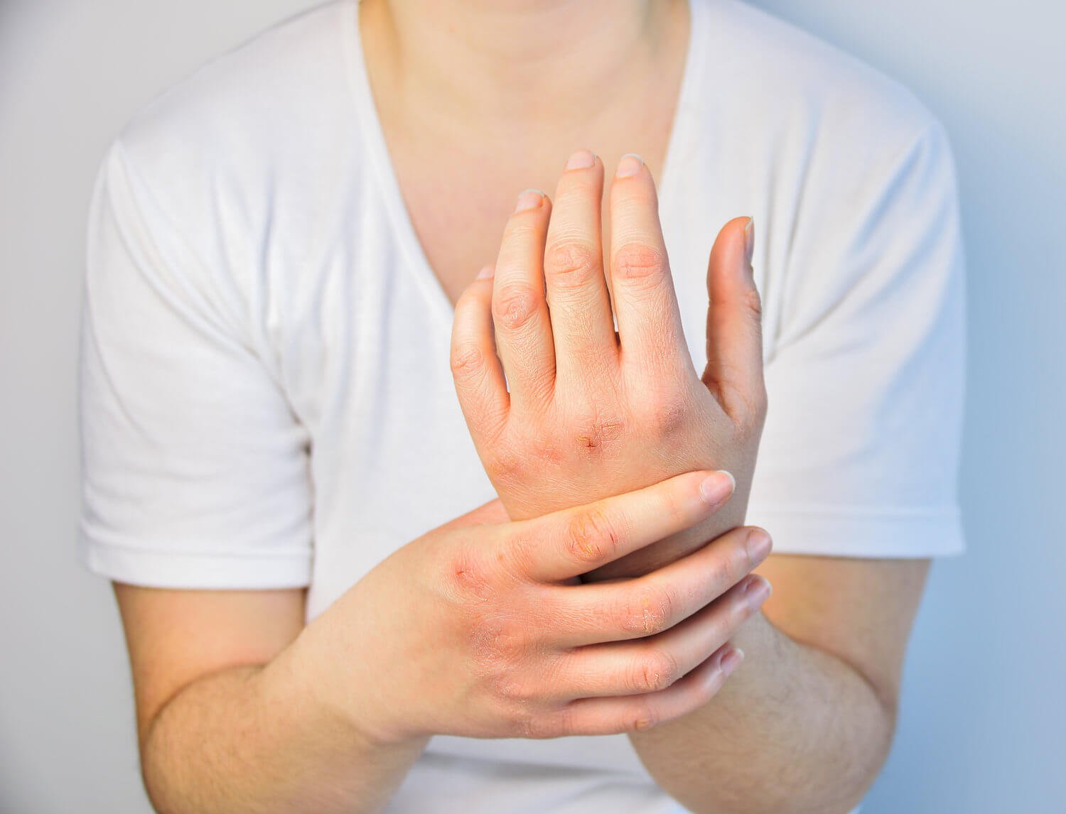 Facts about Psoriatic Arthritis