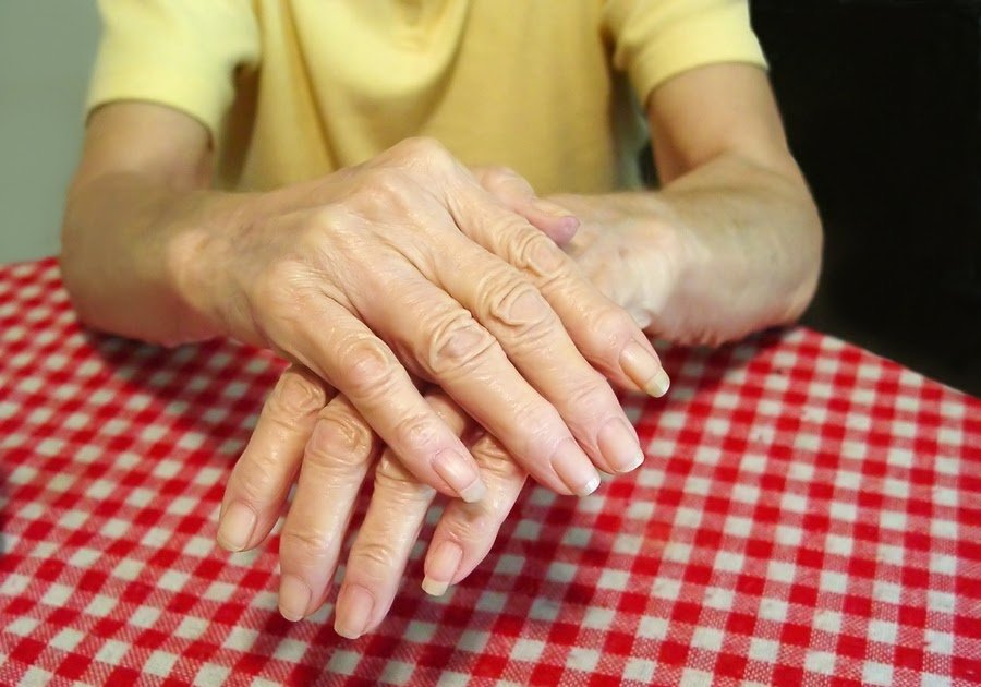 Get How Can I Slow The Progression Of Rheumatoid Arthritis ...