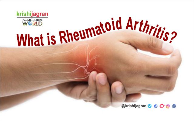 Get Stages Of Rheumatoid Arthritis Hands Background ...