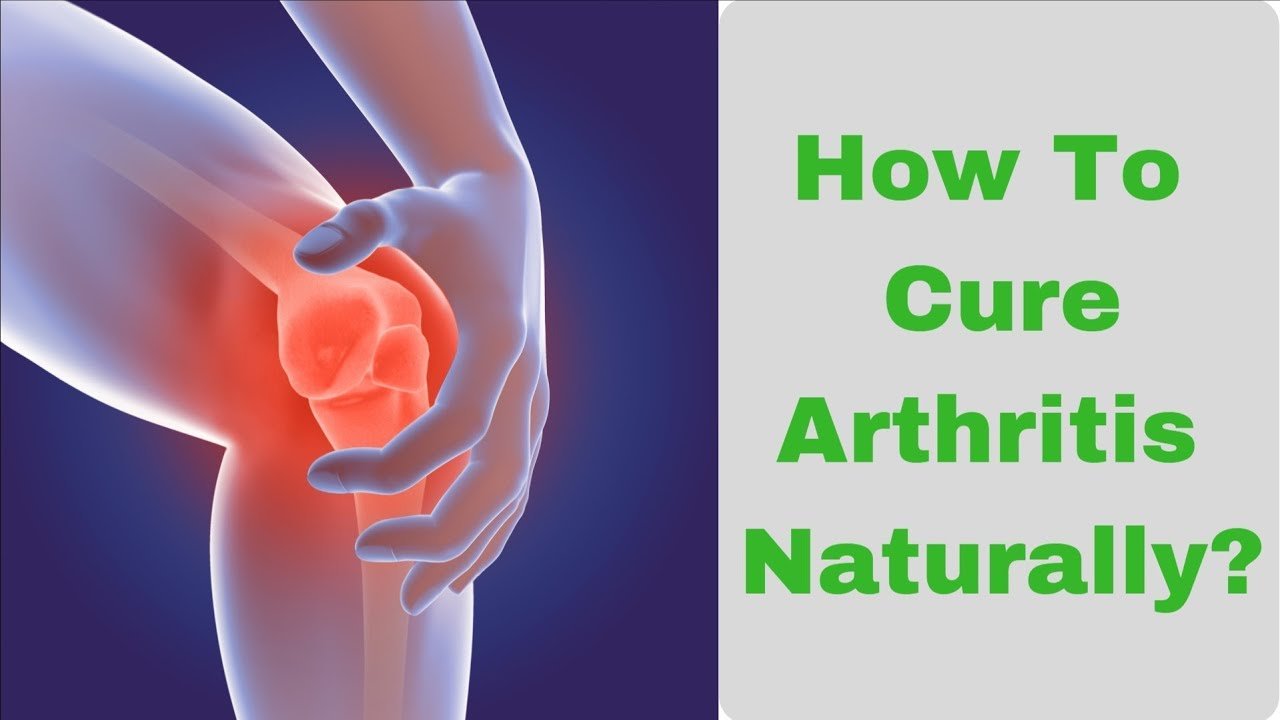 How to Cure Arthritis Naturally at Home?