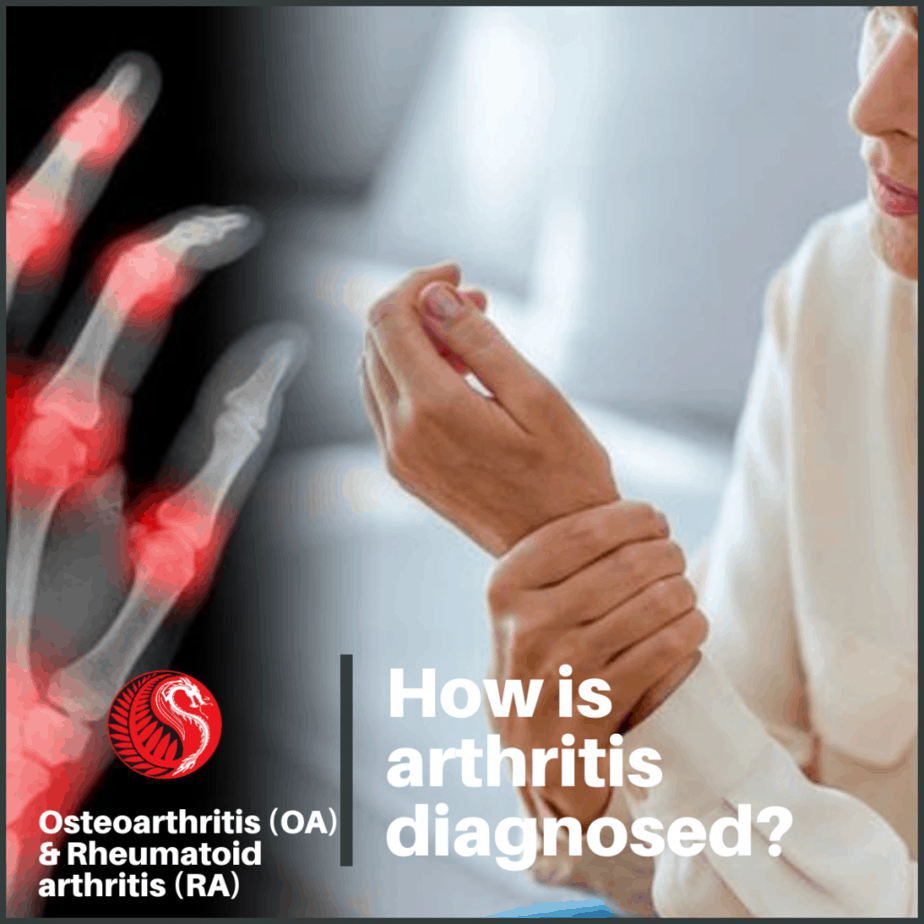 How to Diagnose Arthritis