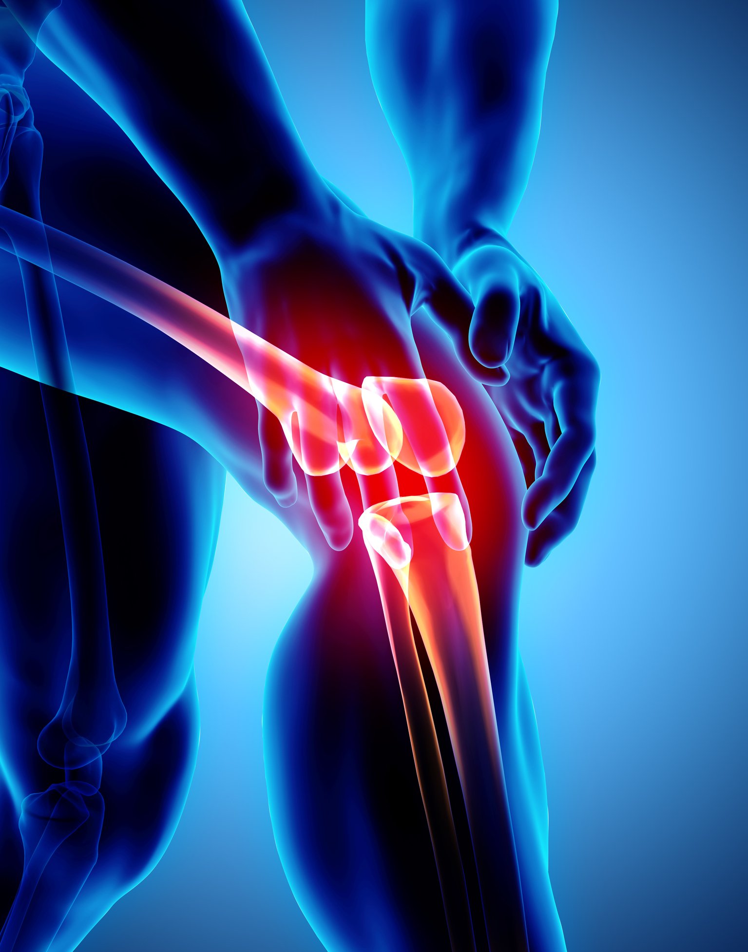 Knee Osteoarthritis and Robotic Knee Replacement
