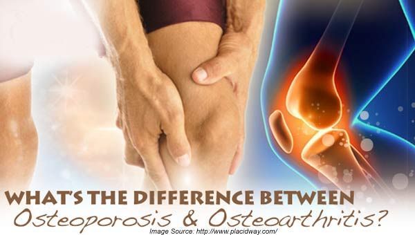 Osteoarthritis and Osteoporosis: Know the Difference!