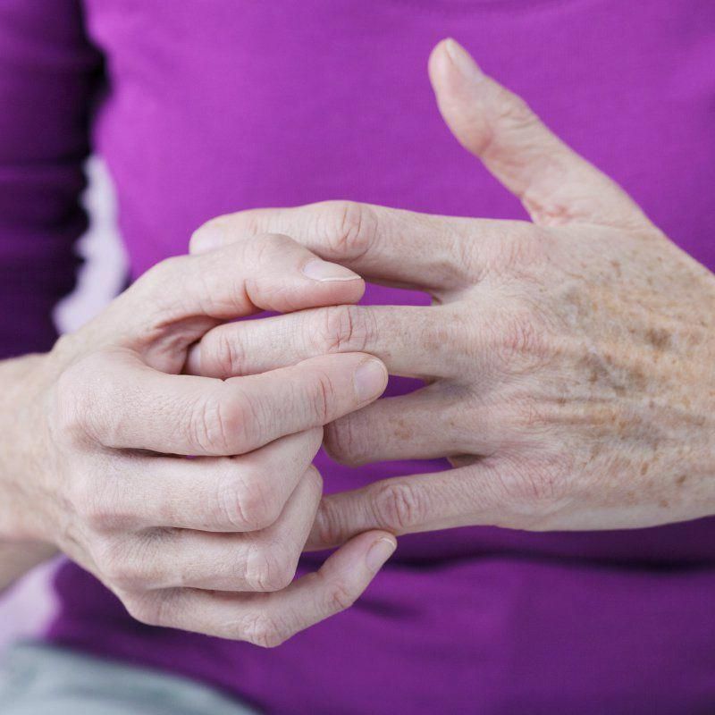 Psoriatic Arthritis: 7 Natural Ways to Relieve Symptoms ...
