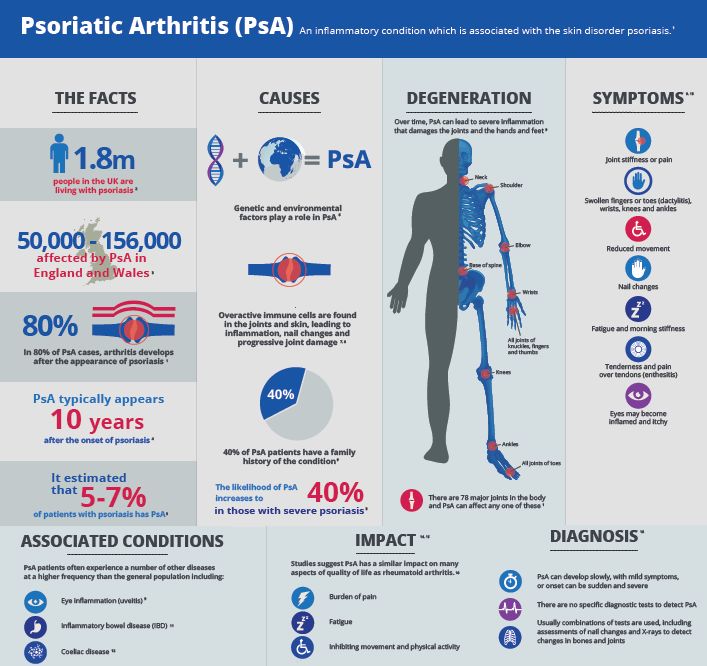 Psoriatic arthritis affects up to one in five people with psoriasis ...