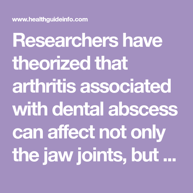 Researchers have theorized that arthritis associated with dental ...