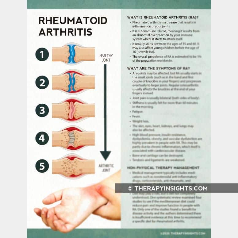 Rheumatoid Arthritis Physical Therapy