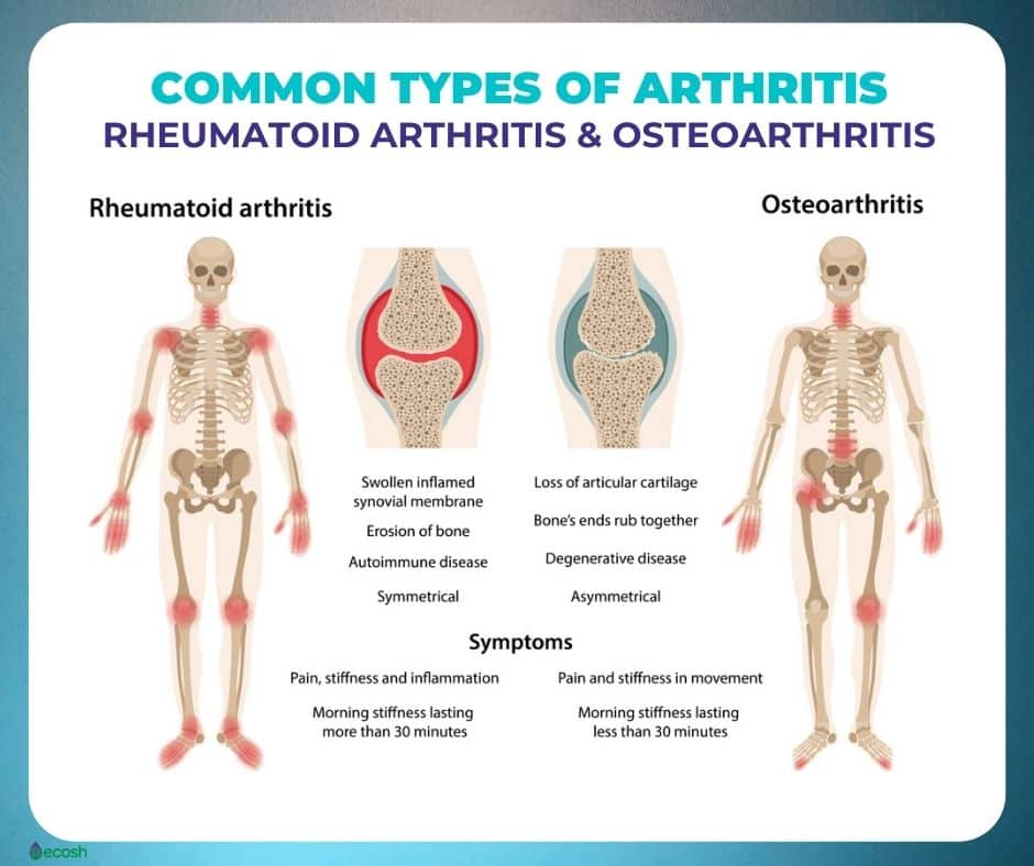 RHEUMATOID ARTHRITIS (RA)