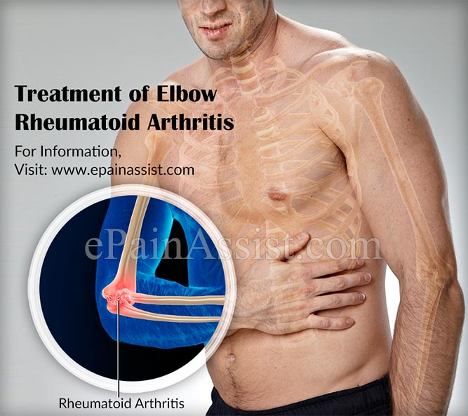 Rheumatoid Arthritis Symptoms In Elbow