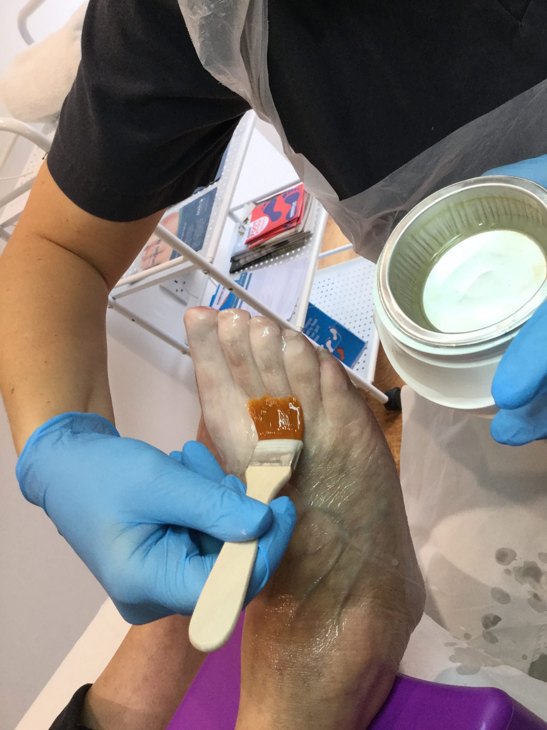 The Benefits of Paraffin Wax Treatments In Podiatry  Care ...