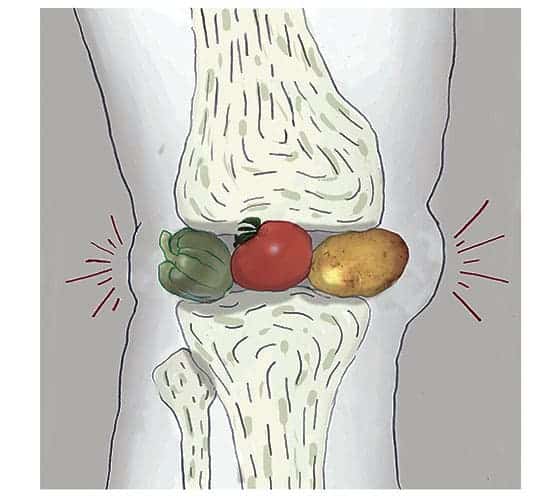 The Claim: Some Foods Can Ease Arthritis Pain