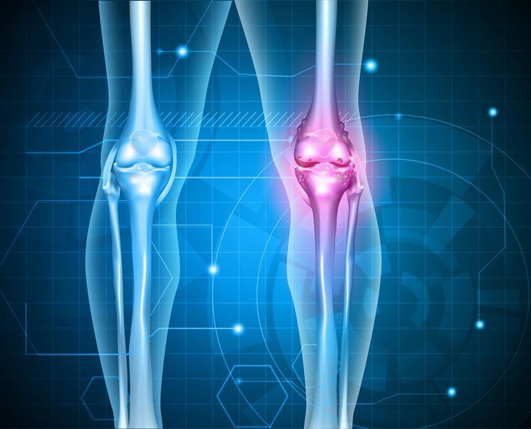 What can Cause Chronic Knee Pain? â Downtown
