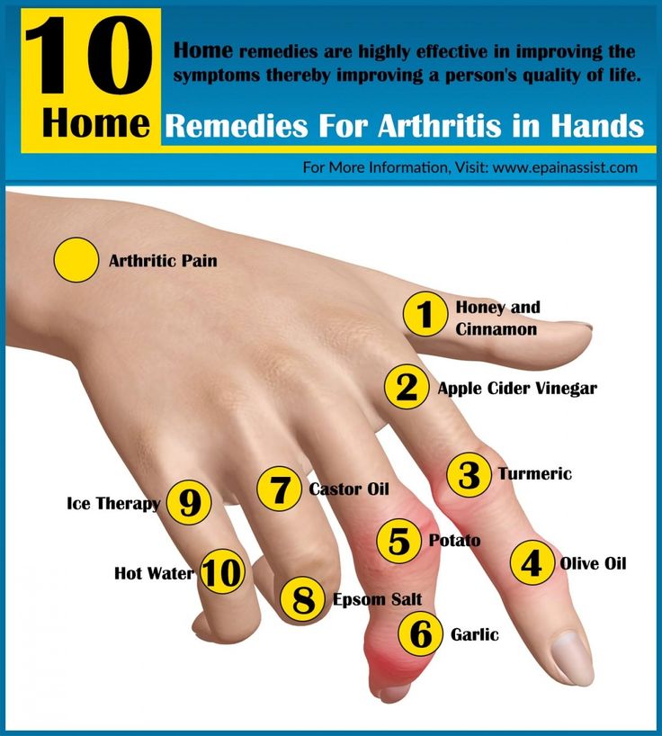 What Helps Arthritis In Hands Check more at http://www.nhprimecare.org ...
