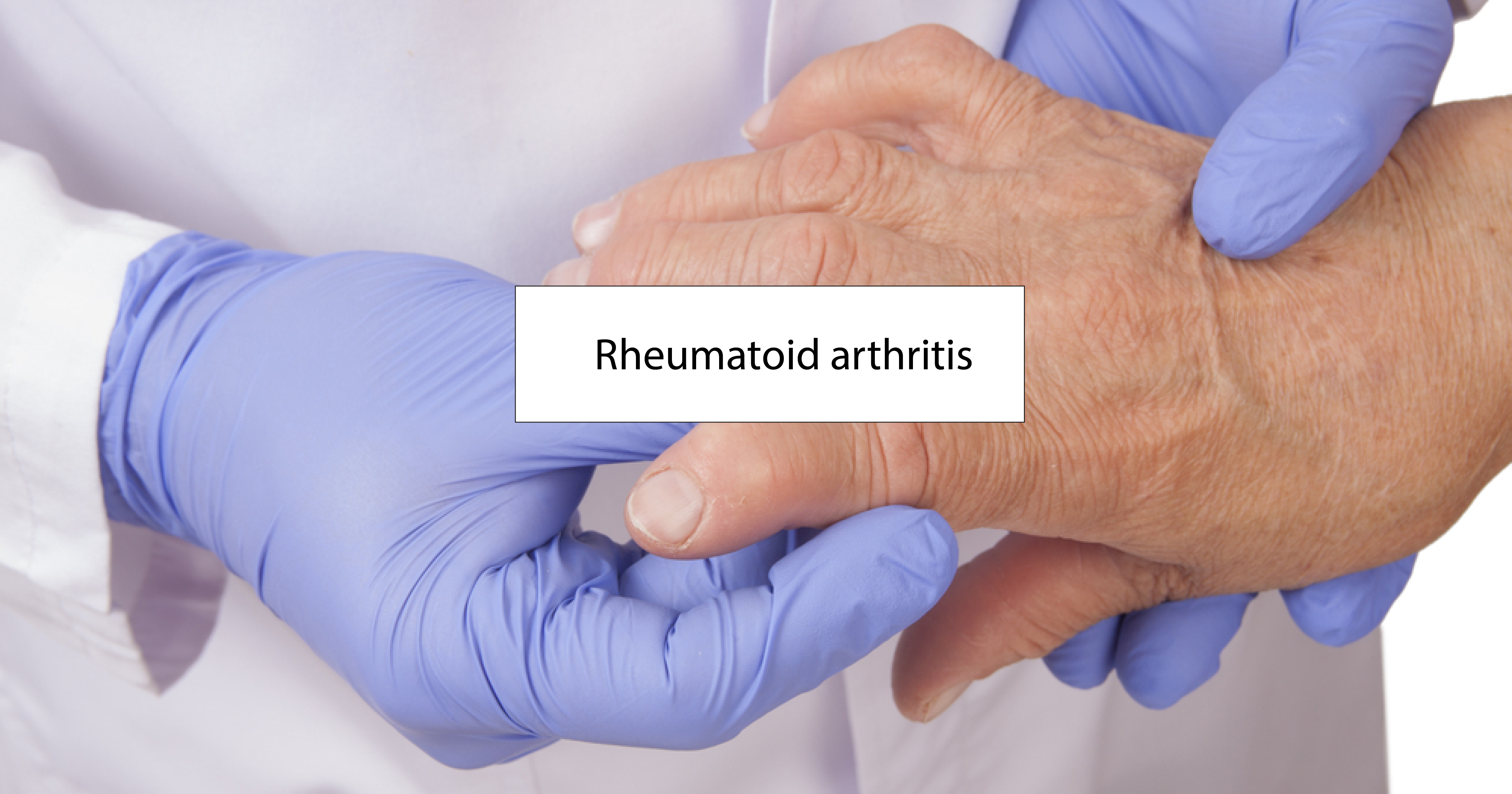 What Is Rheumatoid Arthritis : Can you die from rheumatoid ...