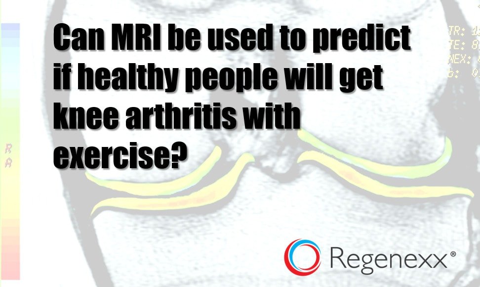 will exercise make my arthritis worse